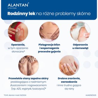 Alantan 20 mg/ 1 g, maść, 30 g - 4 - zdjęcie produktu