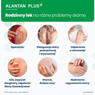 Alantan Plus (20 mg + 50 mg)/ g, maść, 30 g USZKODZONE OPAKOWANIE - 4 Alantan Plus (20 mg + 50 mg)/ g, maść, 30 g USZKODZONE OPAKOWANIE - 4 - zdjęcie produktu