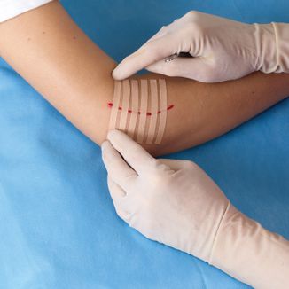 Paski Steri-Strip Viscoplast, do zamykania ran, 6 mm x 75 mm, 6 sztuk - 5 - zdjęcie produktu