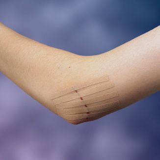 Paski Steri-Strip Viscoplast, do zamykania ran, 6 mm x 75 mm, 6 sztuk - 6 - zdjęcie produktu